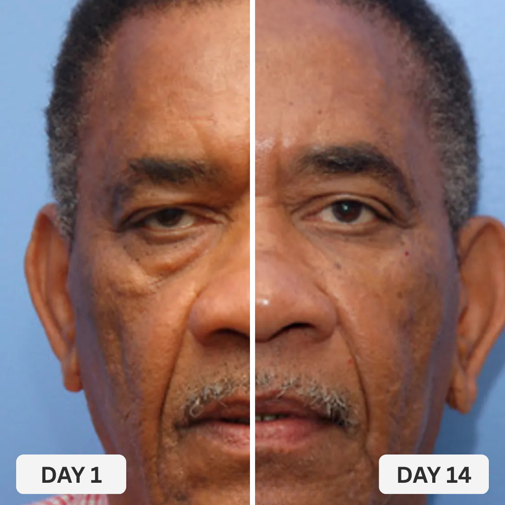 Zevorify Eye Repair Stick