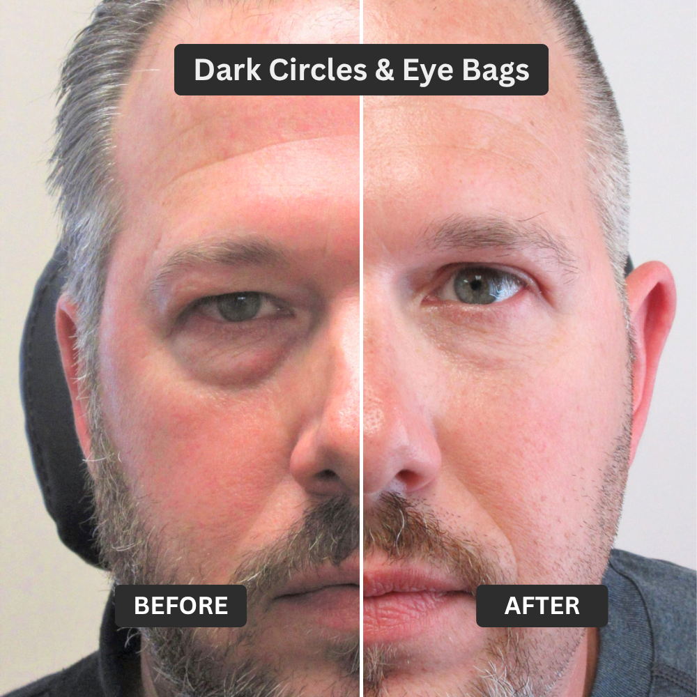 Zevorify Eye Repair Stick