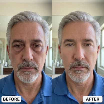 Zevorify Eye Repair Stick