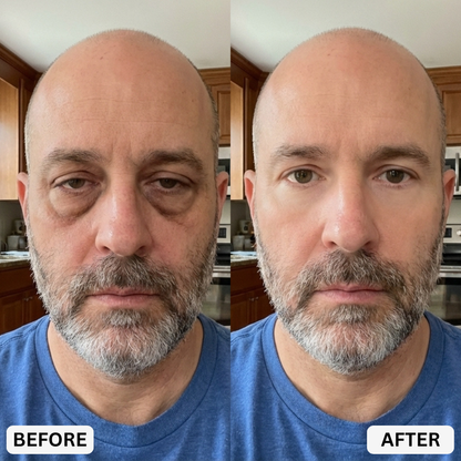 Zevorify Eye Repair Stick