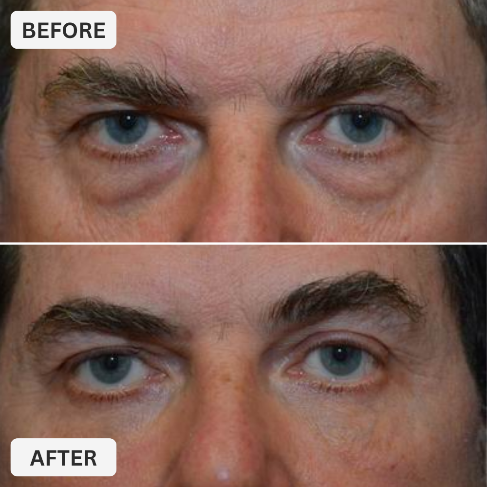 Zevorify Eye Repair Stick