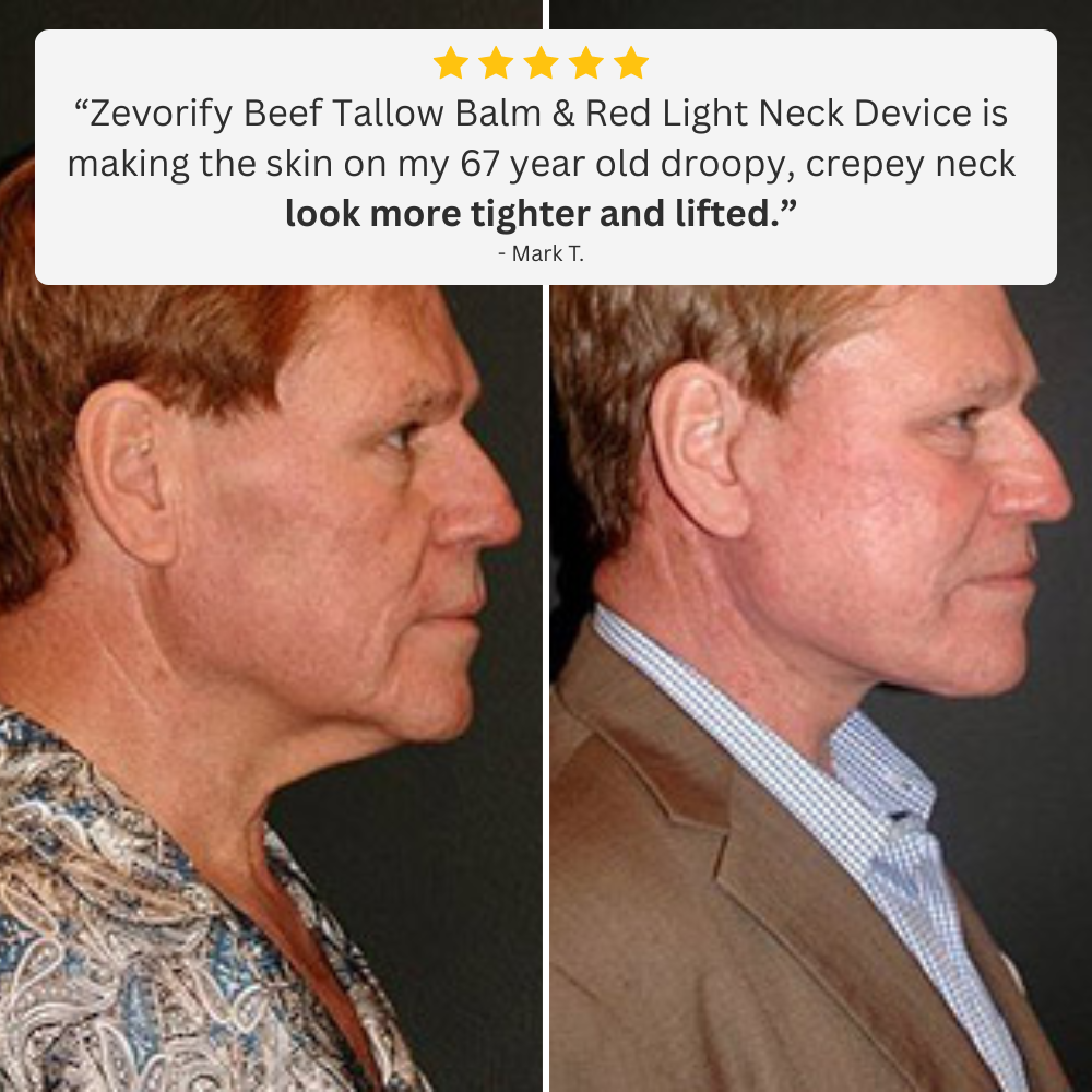 Zevorify Massager Neck Lift Device